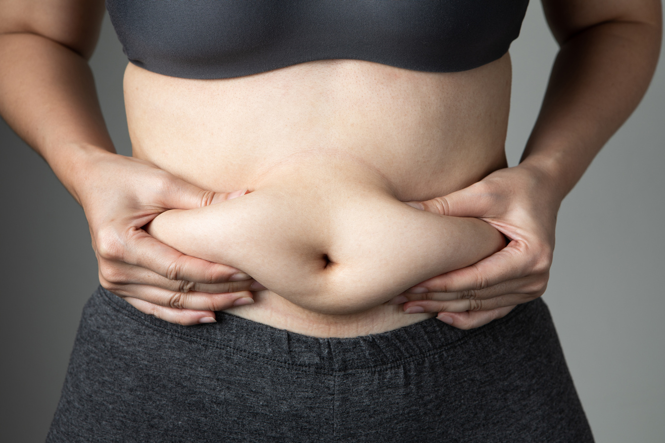 Woman with Cellulite on Her Stomach